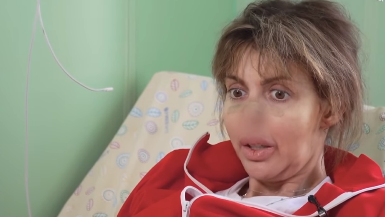 Бывшая жена Аршавина призналась, что ее заразили сифилисом
