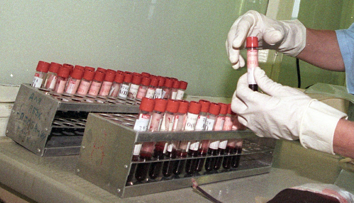 Пермский край оказался на втором месте по количеству зараженных ВИЧ