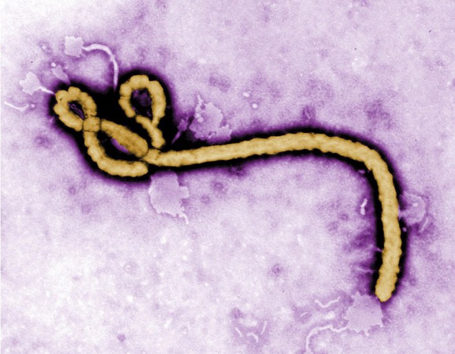 Ebola Congo