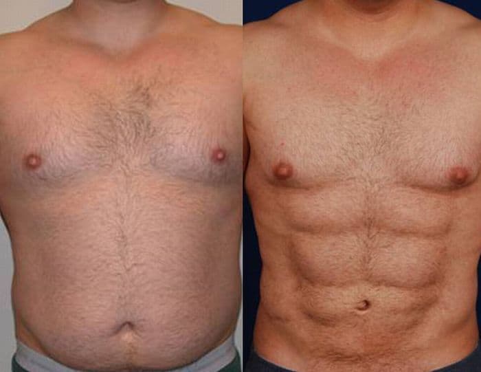 Странные изменения внешности, которые все больше набирают популярность