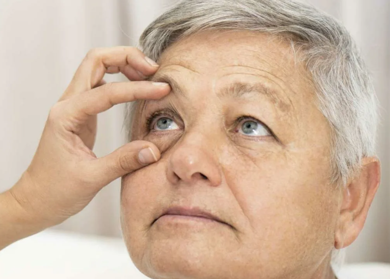 Глаукома - это группа глазных заболеваний, характеризующаяся постоянным или периодическим повышением внутриглазного давления.