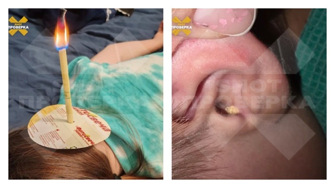 Популярные ушные фитосвечи / Фото: 