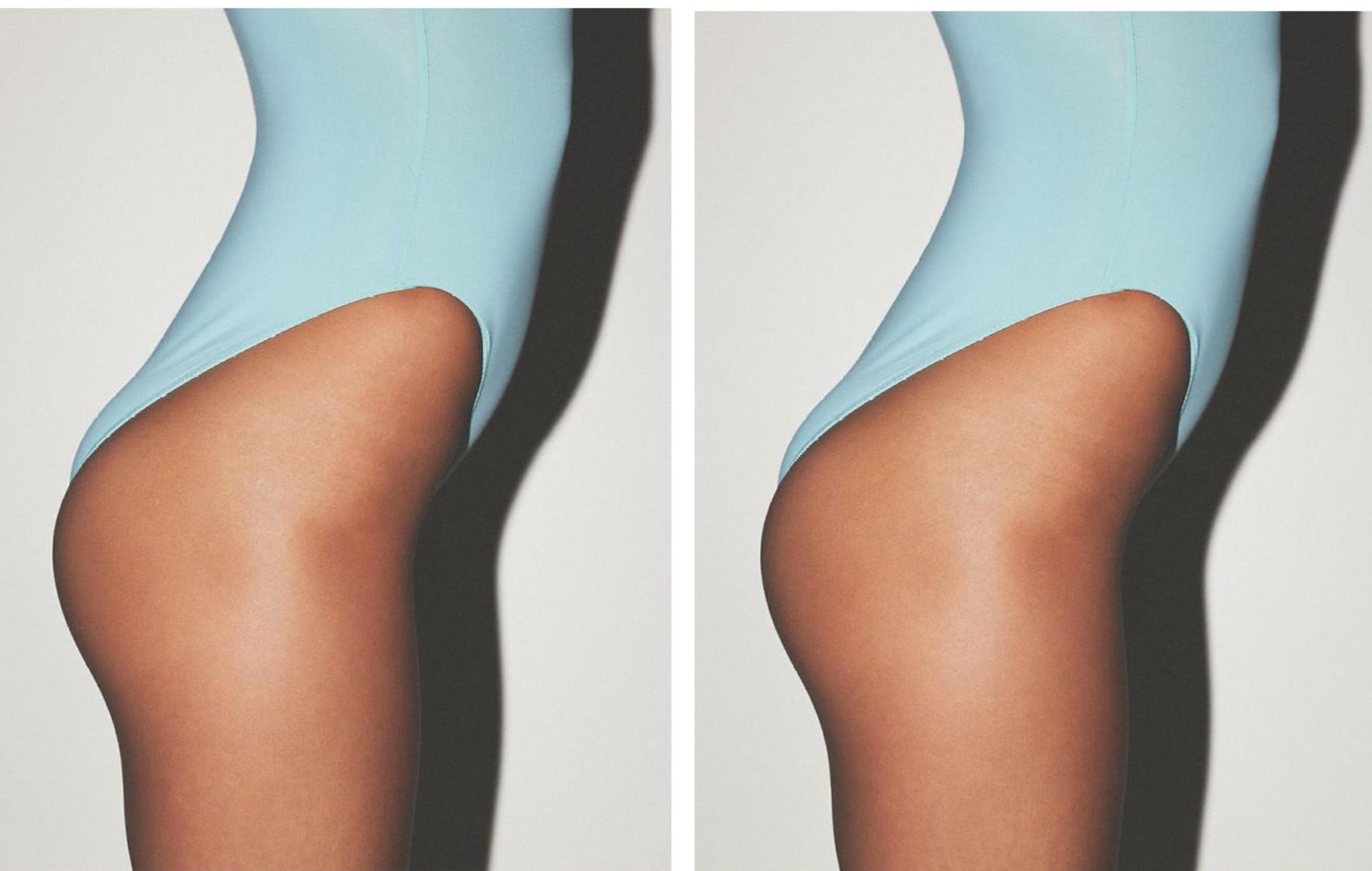 Как убрать «офисную попу»: как сидячая работа меняет фигуру и что делать именно, образ, жизни, только, после, делать, части, нижней, дискомфорт, активность, постепенно, конечно, стоит, лучше, поясницу, происходит, часов, меняется, физиотерапевт, который