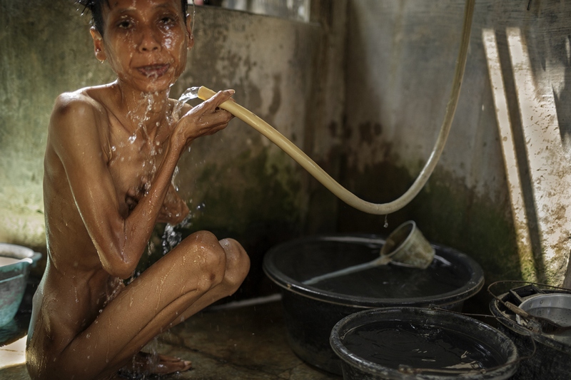 Низшая форма жизни: ужасающие условия индонезийских лечебниц для душевнобольных