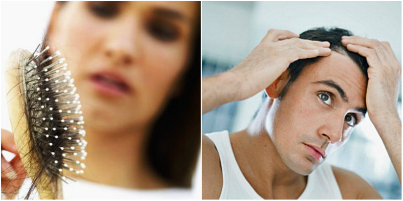 выпадение волос у мужчин и женщин