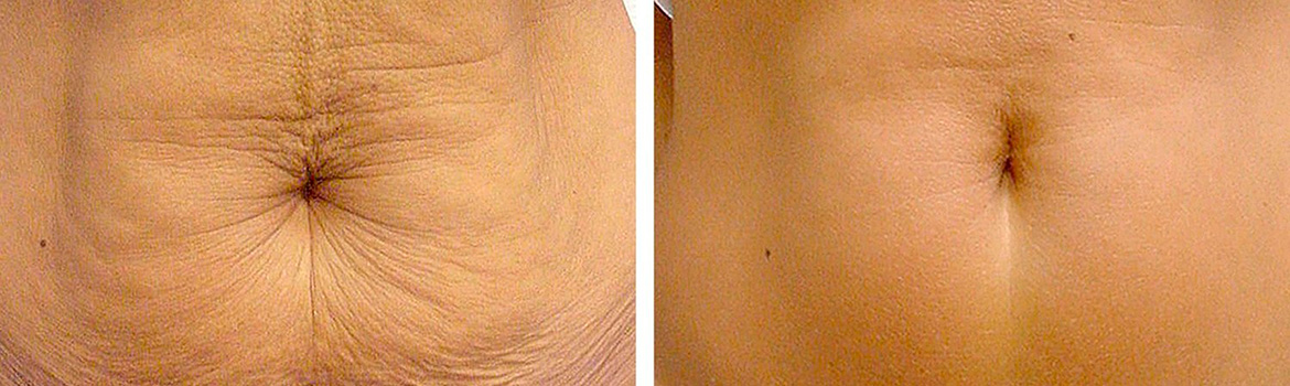 Странные изменения внешности, которые все больше набирают популярность Странные изменения внешности, которые все больше набирают популярность