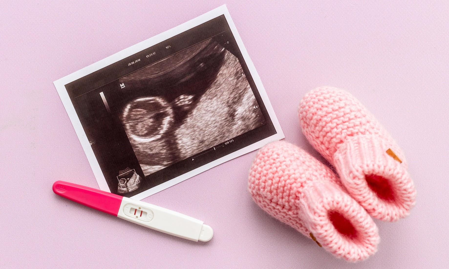 Впервые в России: в Петербурге женщина родила четверых близнецов