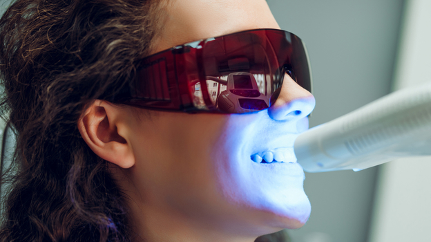 Девушка на профессиональном отбеливании зубов у стоматолога.