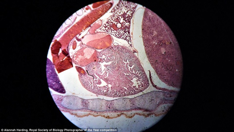 Сердце эмбриона мыши. Фотограф Аланна Хардинг биология, макроснимки, макросъёмка, микрофотографии, микрофотография, претендент, фотоконкурс, фотоконкурсы. природа