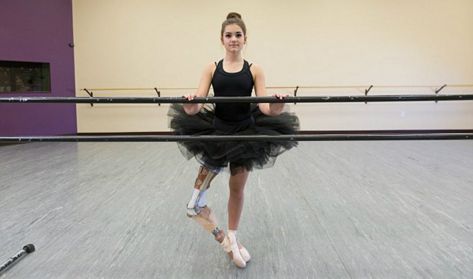 Девушка с протезом ноги стала прекрасной танцовщицей