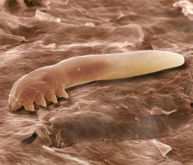 Колонисты человека. Кто обитает на поверхности нашей кожи человека, на коже, бактерий, всего, много, нашего, обитатели, бактериями, кишечника, состав, микроскопические, более, которых, живут, бактерия, количество, только, участках, далеко, отдельный