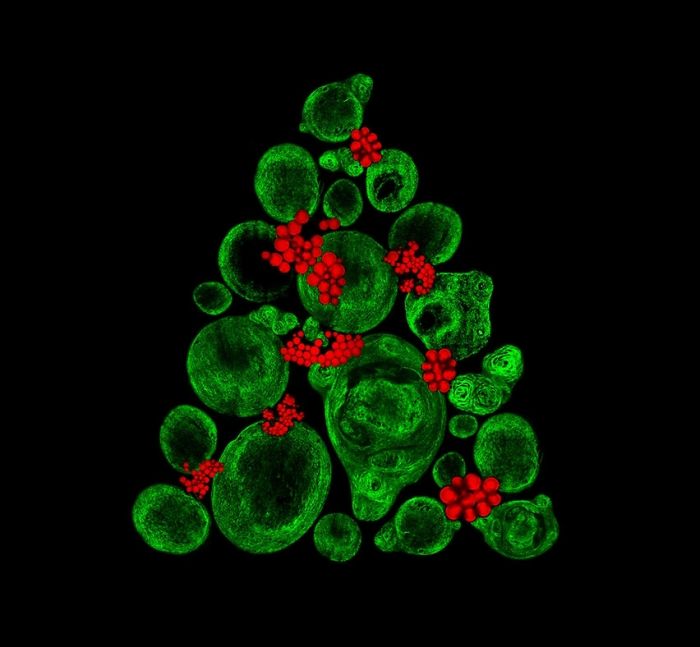 Growing Cartilage-Like Tissue In The Lab Using Bone Stem Cells (Collagen Fibers In Green And Fat Deposits In Red), Southampton, 9th Place