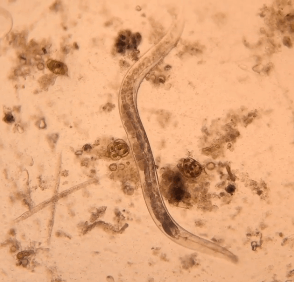 А некоторые товарищи — паразиты в прямом смысле слова в мире, интересно, под микроскопом, познавательно, фото