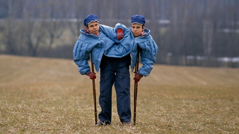 Самые известные сиамские близнецы СССР: жизнь и страдание когда, время, сестры, только, близнецов, сестер, после, сразу, очень, этого, жизни, смерти, другая, близнецы, Кривошляповы, могли, детей, сказали, говорили, сильно