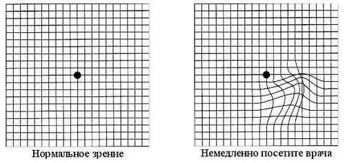 ТЕСТ на наличие заболеваний глаз. Проверьте себя!