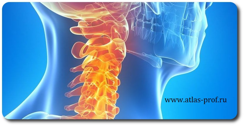Шейный остеохондроз кровообращение. Ддзп шейного отдела. Шейный остеохондроз дистрофические изменения. ДДПП шейого отдела позвоночника. Дистрофия шейных позвонков.