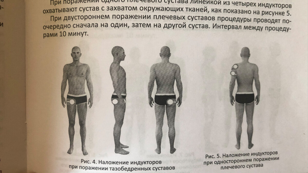 Справа мой случай