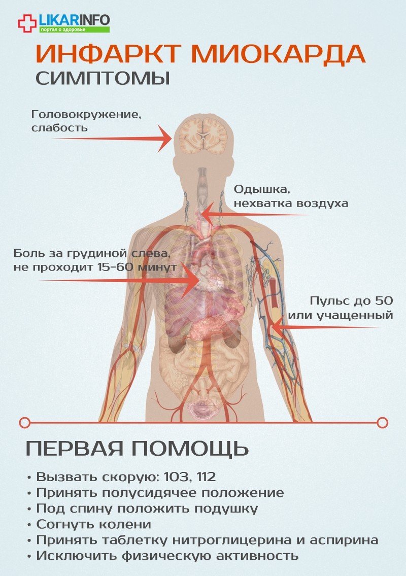 Как начинается инфаркт: просто о сложном. Признаки, стадии, осложнения болезни,здоровье,инфаркт миокарда