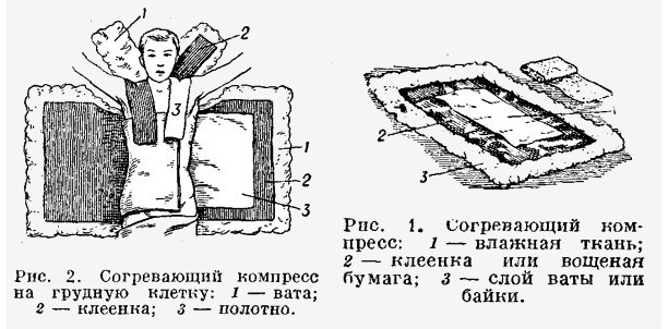 Безжалостная медицина нашего детства родители, только, ребенка, а мама, потом, лечить, вместе, попробовать, потому, горчичники, детей, которую, после, конечно, а сверху, одеялом, засовывали, просто, Родители, растирки