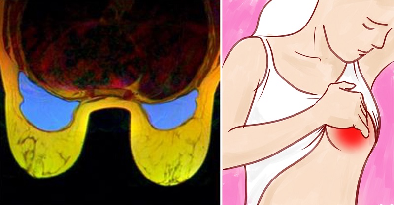 почему нельзя спать в лифчике. почему нельзя спать в лифчике. почему нельзя спать в лифчике подростку. почему нельзя спать в лифчике. у девушки спал лифчик.