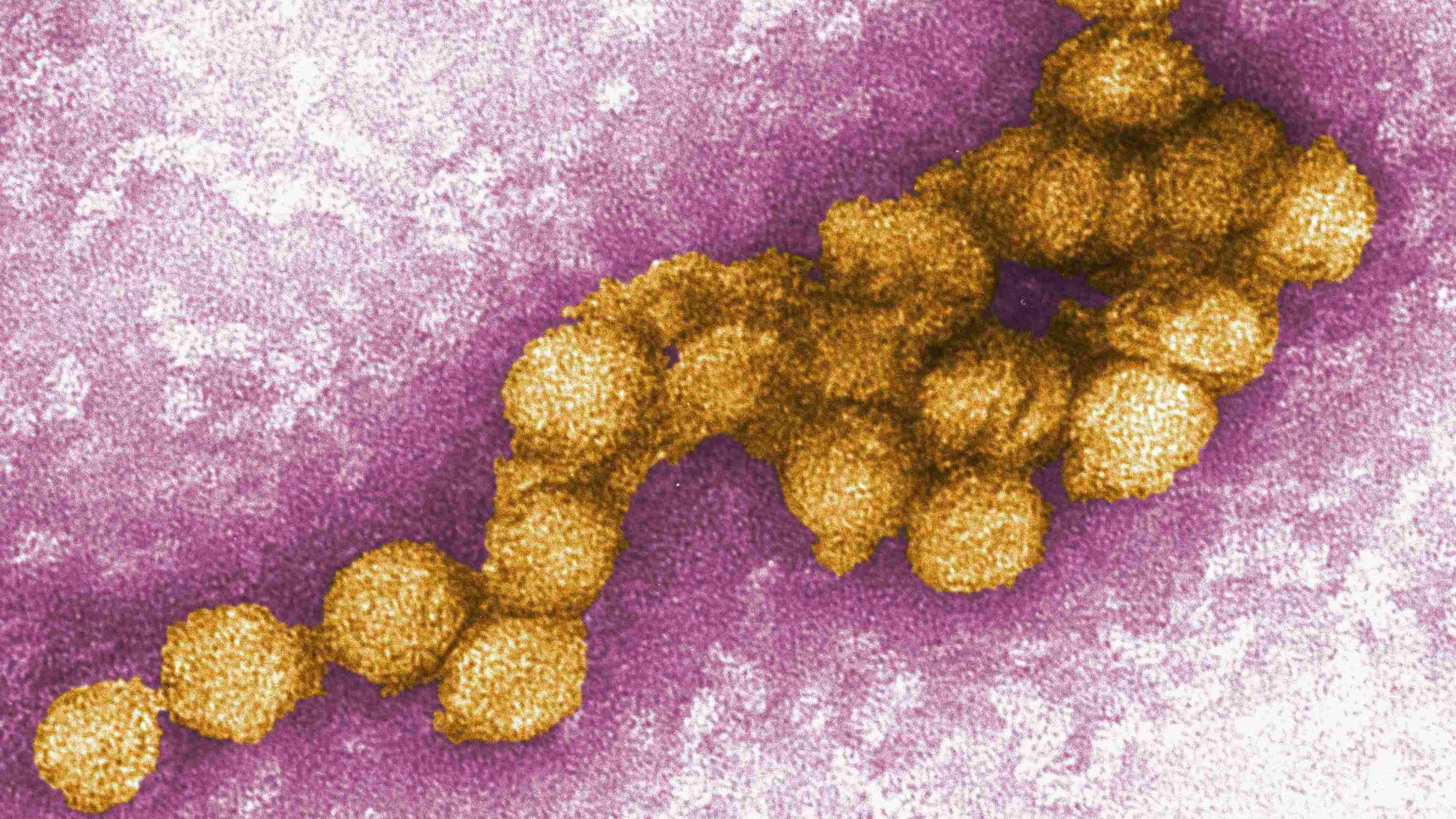 Желтая лихорадка. болезни, вирусы, история, эпидемия
