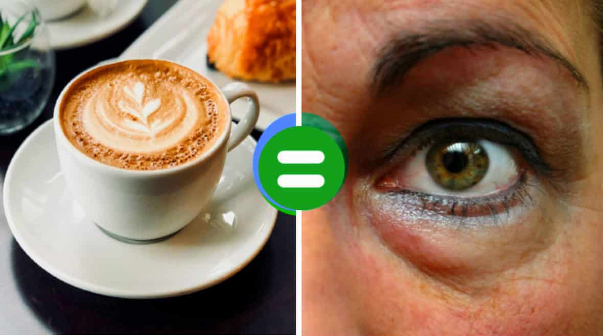 8 продуктов, которые ускоряют СТАРЕНИЕ, и чем их заменить