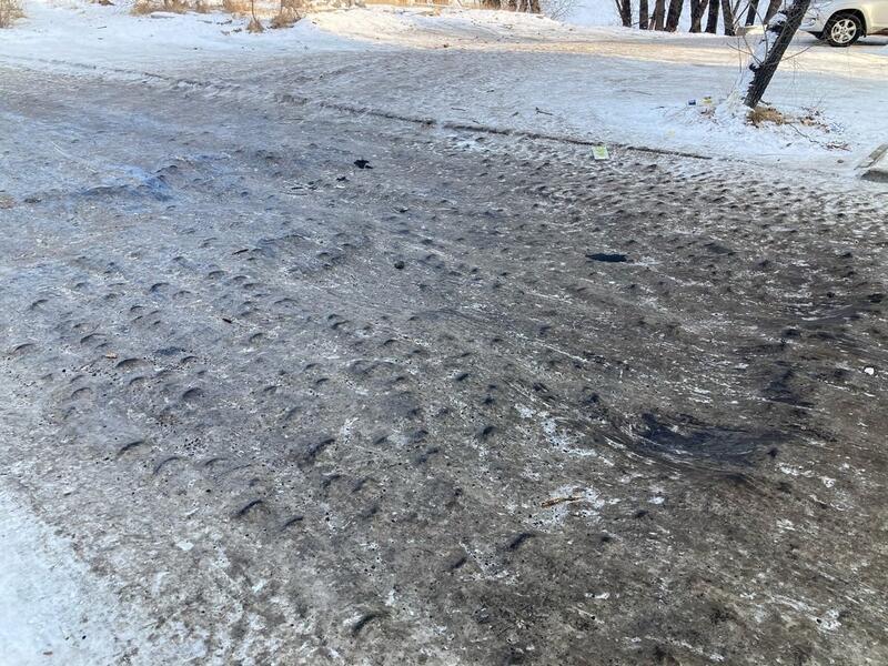 Жительница Читы отсудила 70 тысяч рублей у городской администрации за травму на скользком тротуаре
