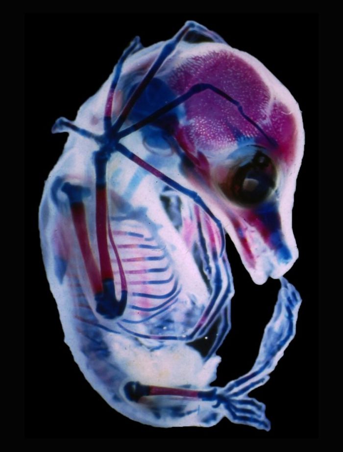 3rd Trimester Fetus Of Megachiroptera, Colorado, 15th Place