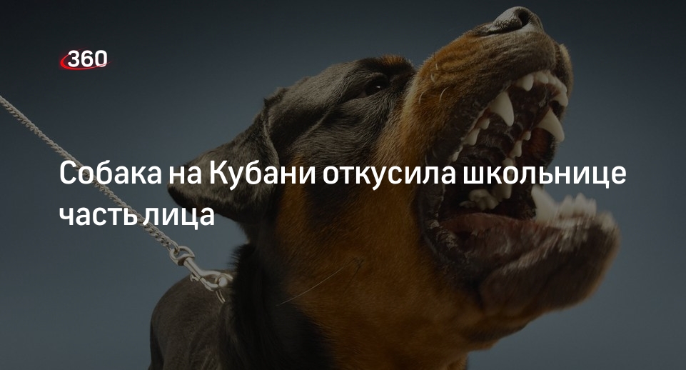 Kp.ru: на Кубани собака откусила 15-летней девочке часть лица