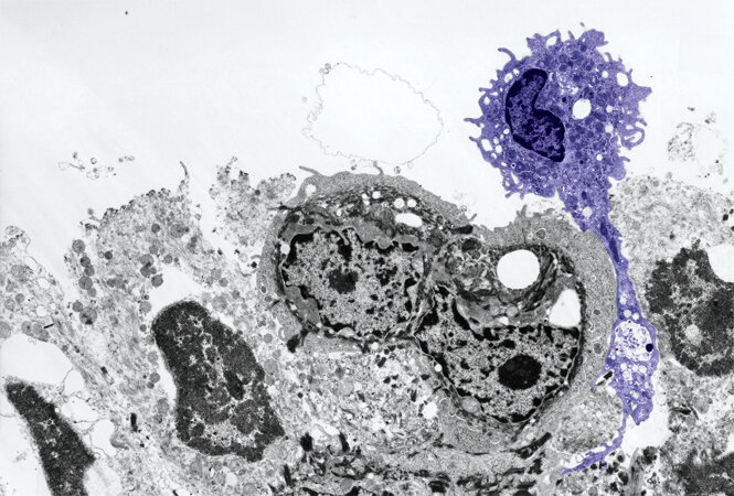 Первая линия защиты. Дендритные клетки (фиолетовые) обнаруживают патоген (маленькая красная точка), запуская иммунный ответ с помощью активации Т-клетки.