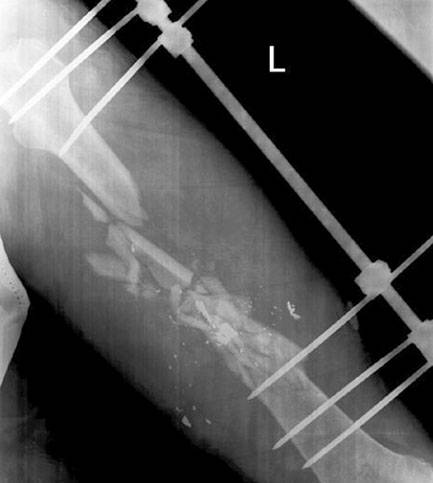 Новости не нашей науки: гидрогель от переломов Новости не нашей науки: гидрогель от переломов оружие