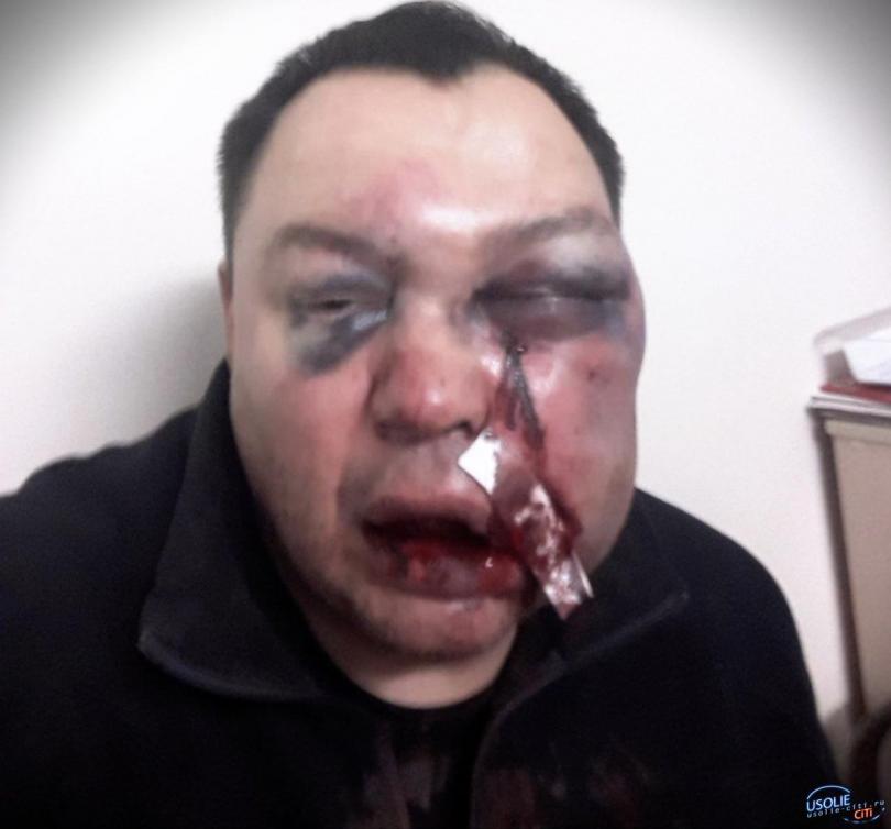 Экс-депутата зверски избили после критики иркутского губернатора-КПРФщика