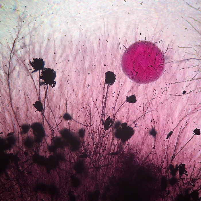 Aspergillus Flavus (Fungus) And Yeast Colony From Soil, New York, 20th Place