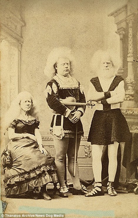 Члены семьи альбиносов Лукази были знаменитыми артистами в XIX веке деформация, люди