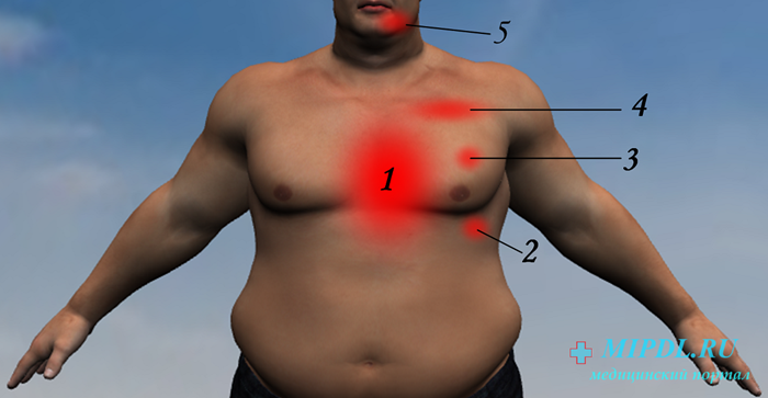 Лево мышцы болит. Болит под грудиной слева. Болит левая сторона груд.