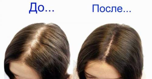 Как укрепить тонкие ослабленные волосы и сделать их гуще. Почему волосы становятся ослабленными и выпадают? 04