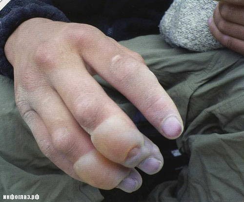 Кладбище на Эвересте Кладбище на Эвересте поездка,туризм