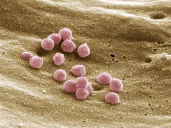 Клетка, инфицированная ВИЧ. Источник изображения: THOMAS DEERINCK, NCMIR/SCIENCE PHOTO LIBRARY / Getty Images
