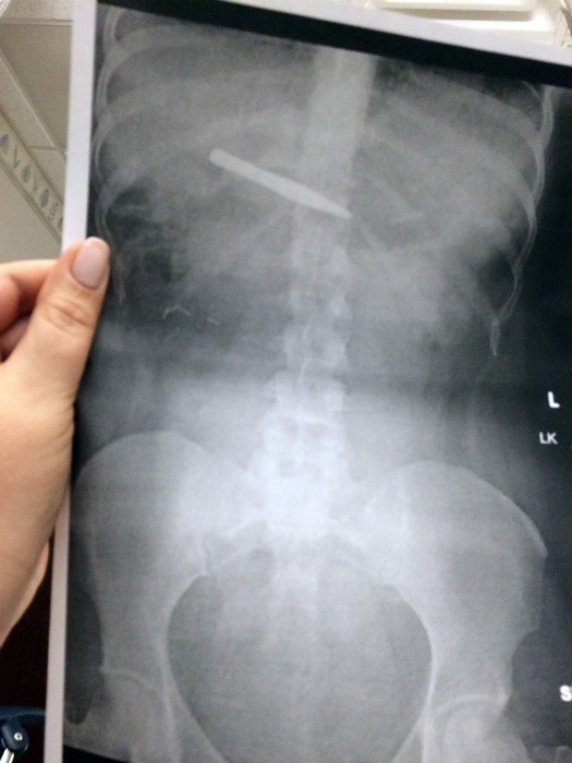 16 забавных фотографий про странную логику, терпимость и принятие внутри семьи 16 забавных фотографий про странную логику, терпимость и принятие внутри семьи Жизнь,Истории,Отношения,проблемы