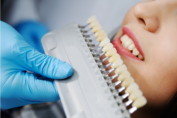 Опасные инструменты и адская боль: 6 советских мифов о стоматологах, в которые многие до сих пор верят медицина,стоматология