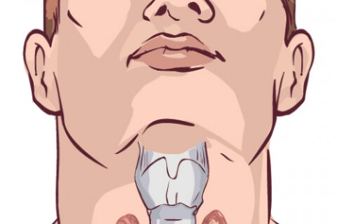 Что делать, если щитовидная железа ослаблена: 7 советов здоровье,щитовидная железа