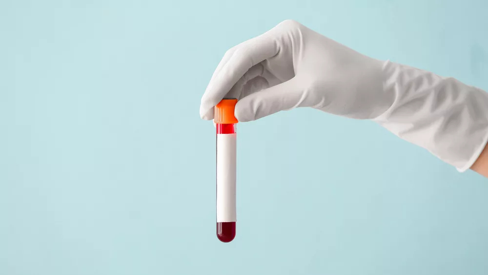 Новый анализ крови позволит предупредить о болезни Паркинсона до появления симптомов