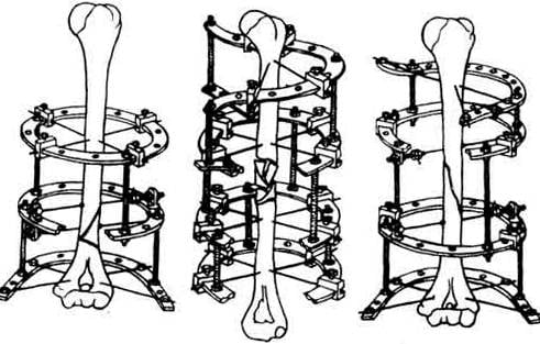 Новости не нашей науки: гидрогель от переломов Новости не нашей науки: гидрогель от переломов оружие