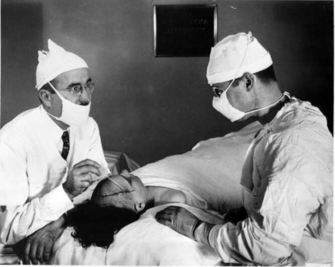 Операция, которой люди боялись веками: 10 фактов о лоботомии здоровье,история,медицина,наука,открытия
