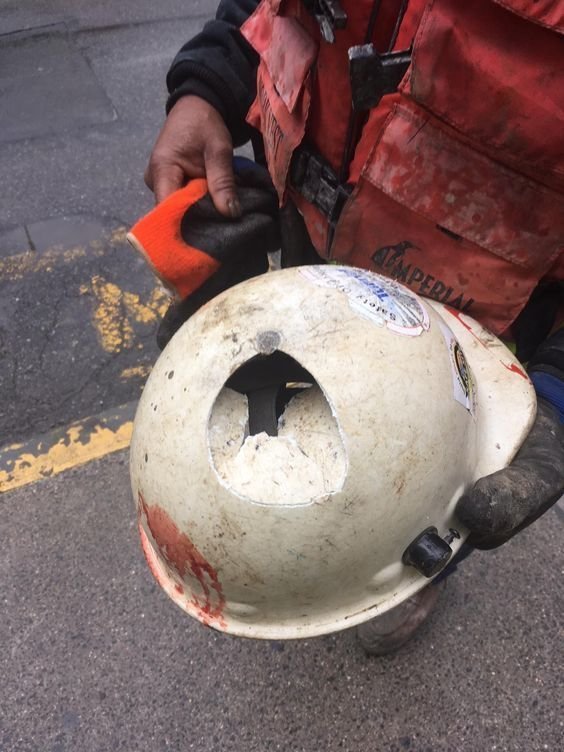 На волосок от смерти: эти люди сами не понимают, как сумели выжить На волосок от смерти: эти люди сами не понимают, как сумели выжить