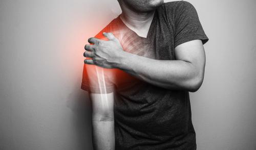 Артрит плечевого сустава мкб-10. Артрит плечевого сустава (МКБ 10 – М13.8): причины и симптомы
