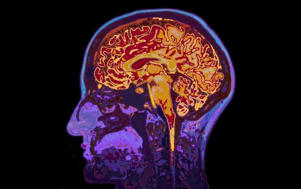 10 любопытных фактов о нашем мозге мозга, больше, энергии, нейроны, мозге, веществ, орган, например, время, может, скоростью, нейронов, питательных, часть, самый, процесс, крови, используется, энергозатратный, информацию