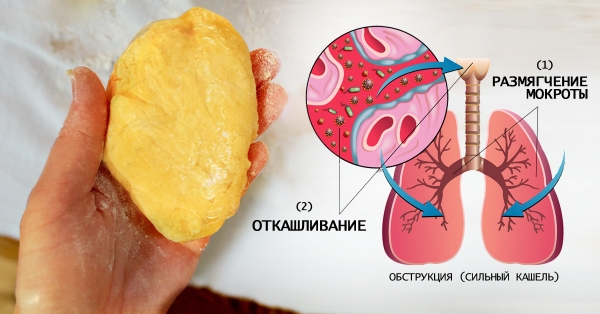 Как сделать компресс для лечения кашля