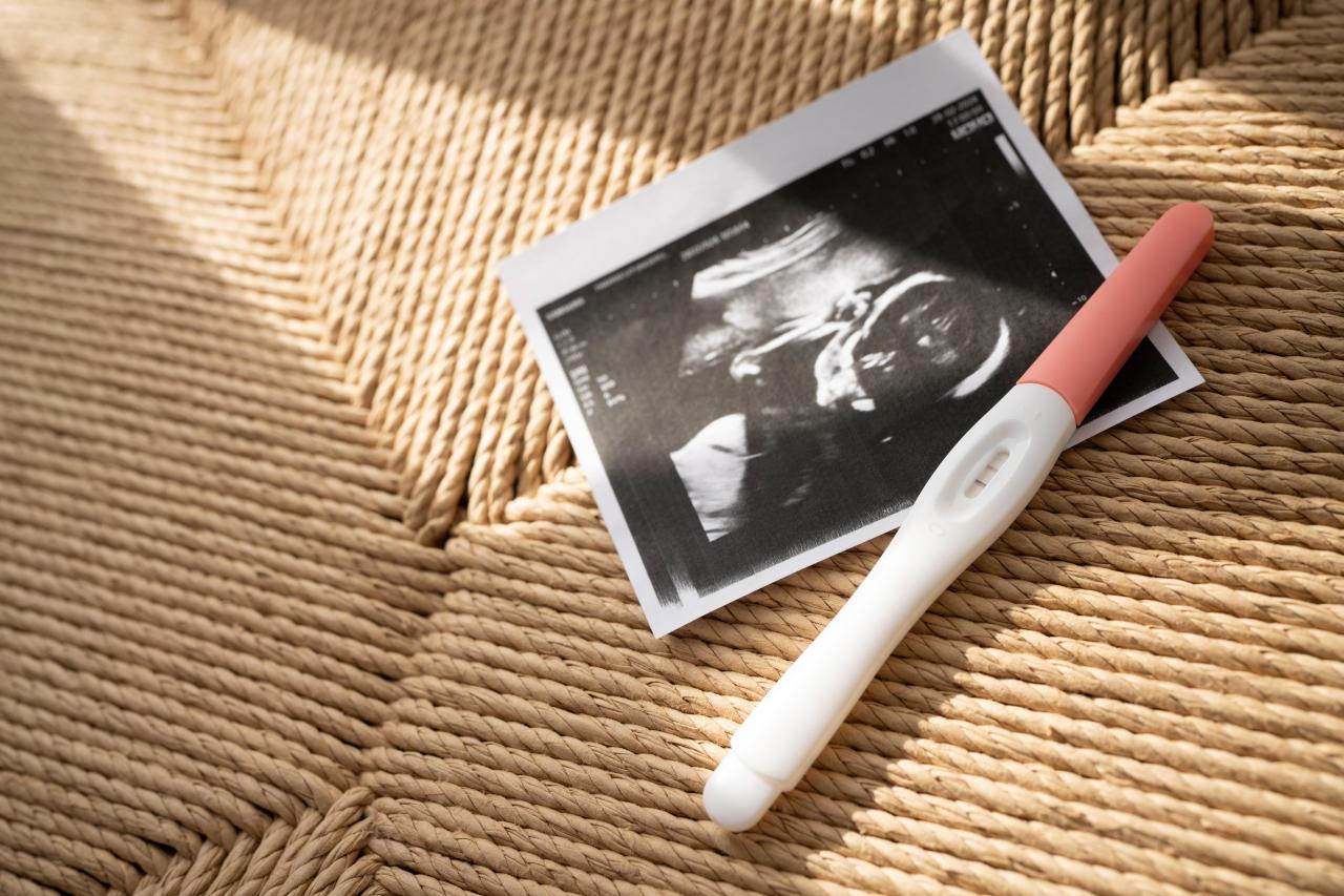 Что такое биохимическая беременность: признаки и возможные причины беременность, может, беременности, уровень, Карина, биохимическую, неделю, кровотечение, обычно, можно, которое, такое, биохимической, сообщила, крови, только, через, теста, сроке, визуализируется