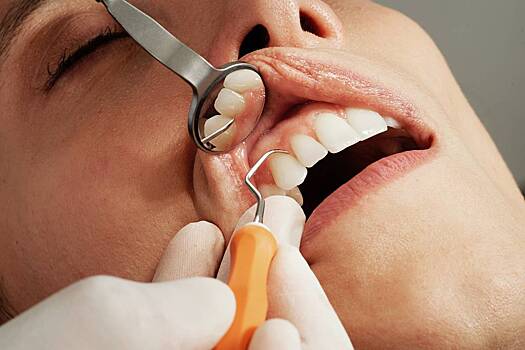 Стоматология: основные причины появления прозрачности зубов